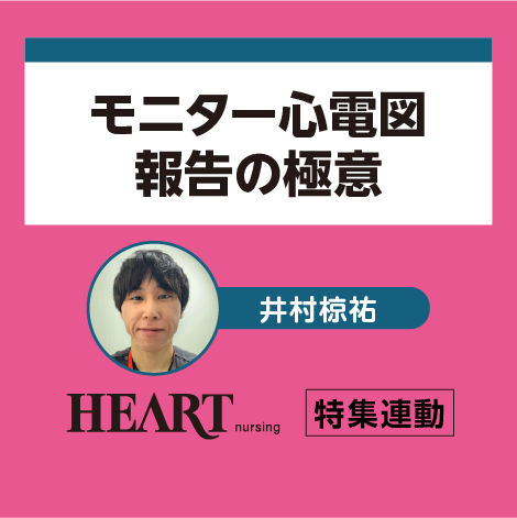 モニター心電図報告の極意